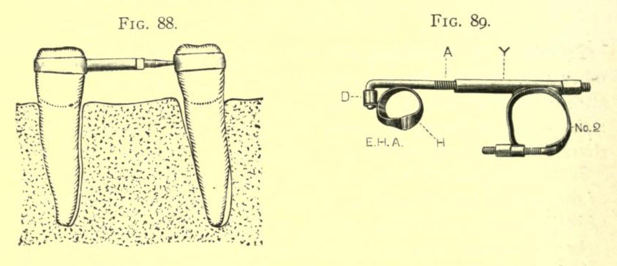 1898_Angle_Fig 88