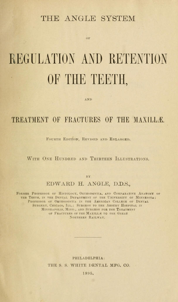 1895_The Angle system of regulation and retention of the teeth and treatment of fractures of the maxillae