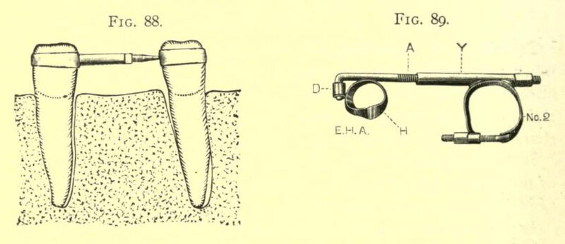 1898_Angle_Fig 88